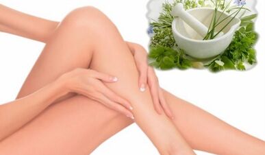 Tratamento das varices das extremidades inferiores con remedios populares