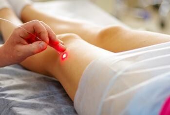 Tratamento con láser de varices