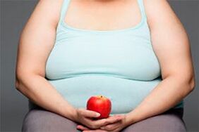 Para curar as varices, cómpre perder o exceso de peso