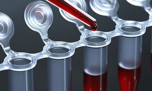 análise de sangue para varices nas pernas